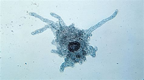 Eyeless Amoeba – Discover This Unassuming Microorganism With Surprisingly Complex Behaviors!