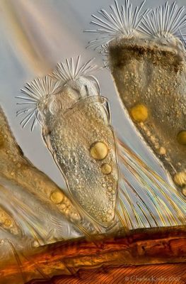  Orchestrides! A Glimpse into the Microscopic World of These Elegant Ciliates