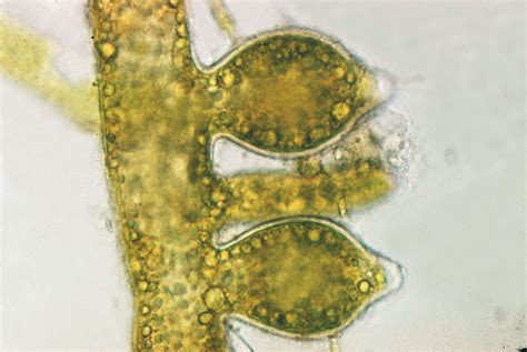  Yellow-Green Algae! A Microscopic Mastermind of Aquatic Ecosystems